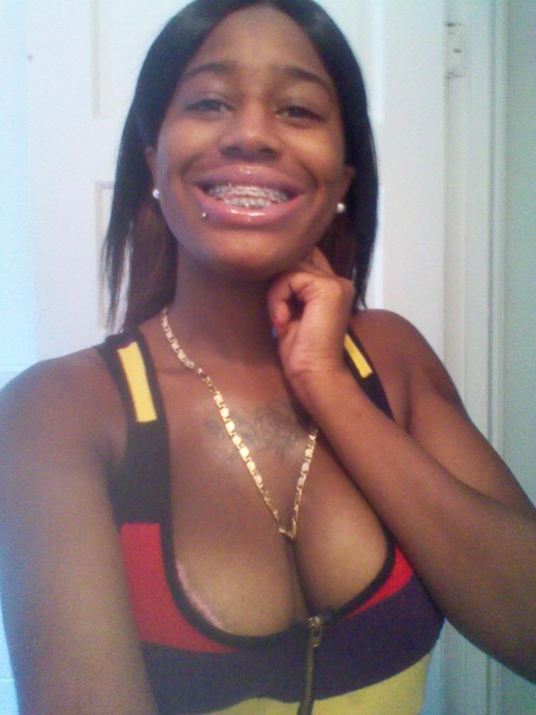 Black Pornstar With Braces